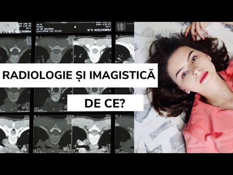 Video: Cine este specializat în interpretarea imagistică medicală?