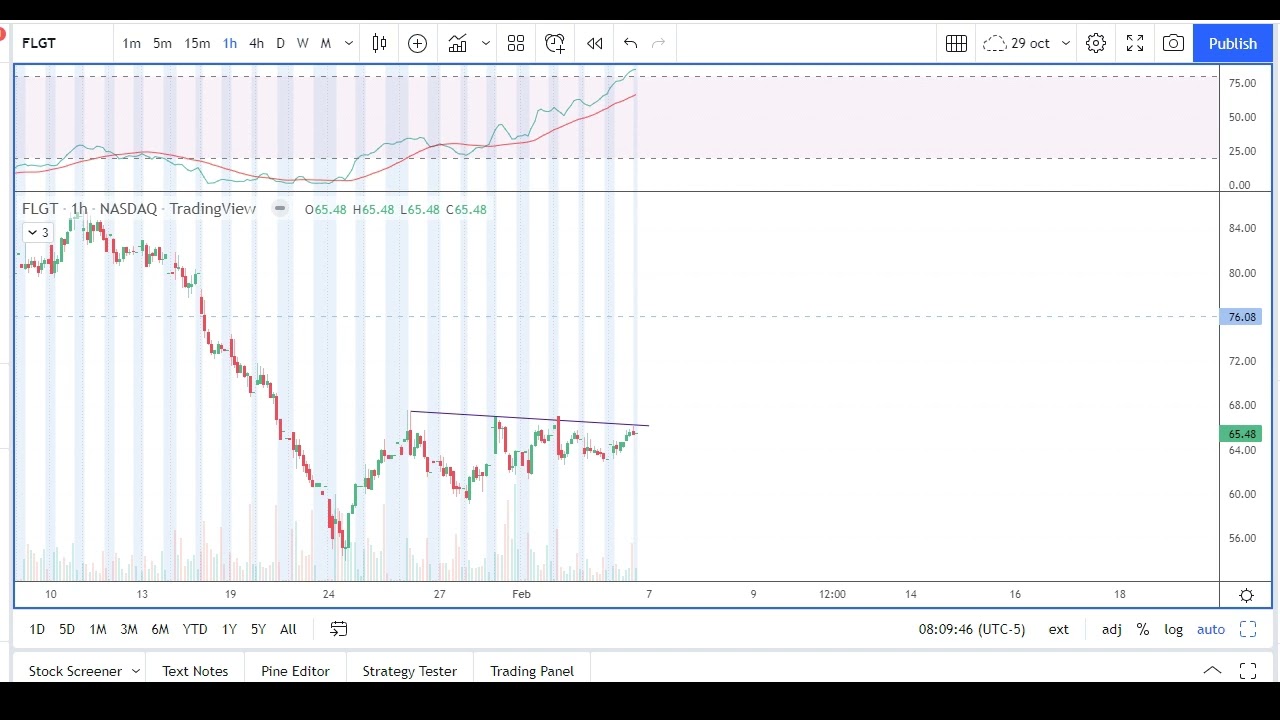 FLGT stock chart analysis to trade. Weekly Watchlist Feb 7-11, 2022