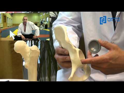 Видео: Поправяне на фрактура на костта: процедура, подготовка и рискове