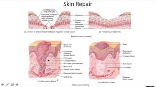 The Integumentary System 4   Skin Repair