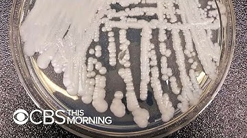 CDC warns about drug-resistant superbug fungus Candida auris