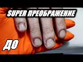 SUPER ПРЕОБРАЖЕНИЕ НОГТЕЙ ГРЫЗУНЧИКА💥