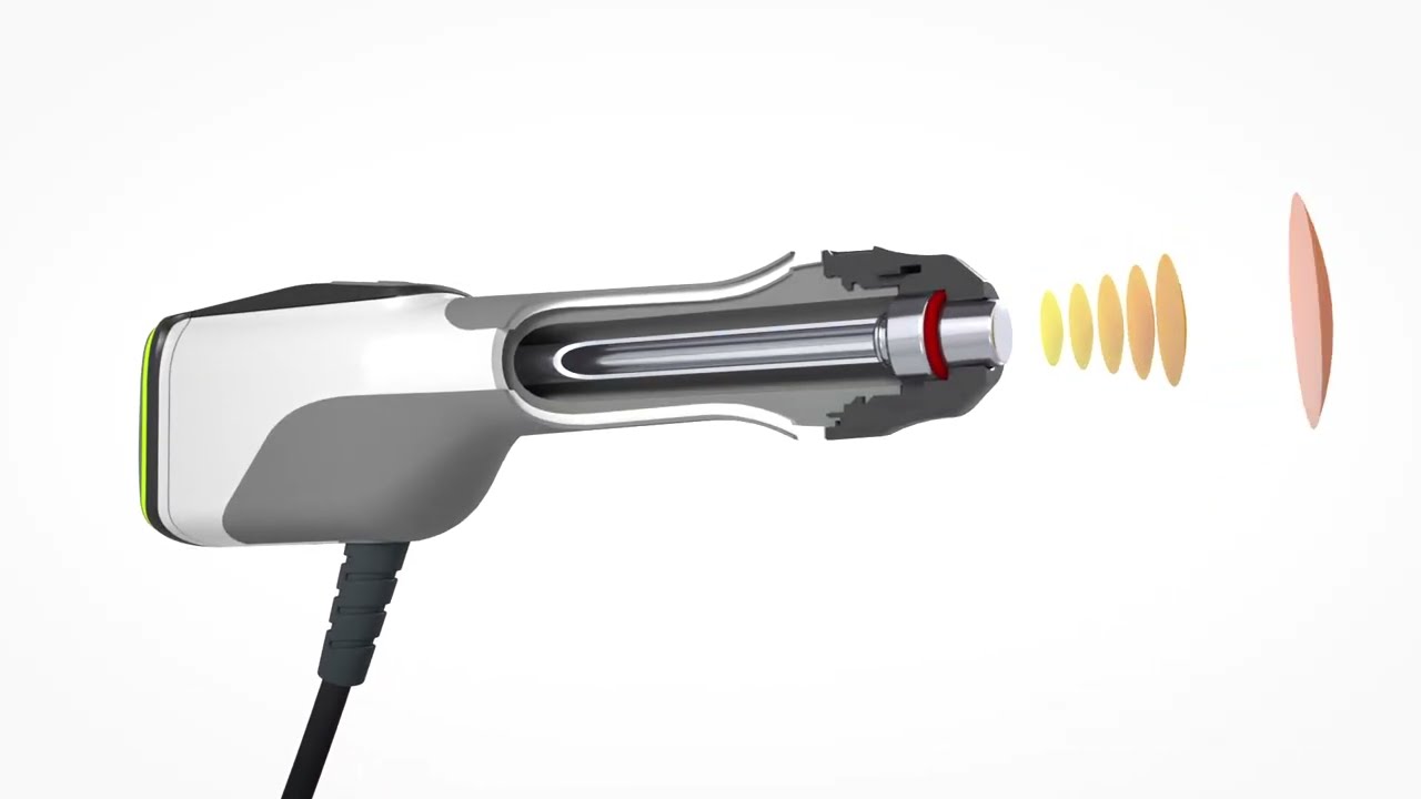 MASTERPULS® icon »Deep« Radial Shockwave - Remington Medical