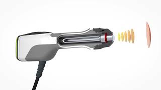 MASTERPULS® icon – Radial Shock Wave Therapy System for Clinical Practice | STORZ MEDICAL
