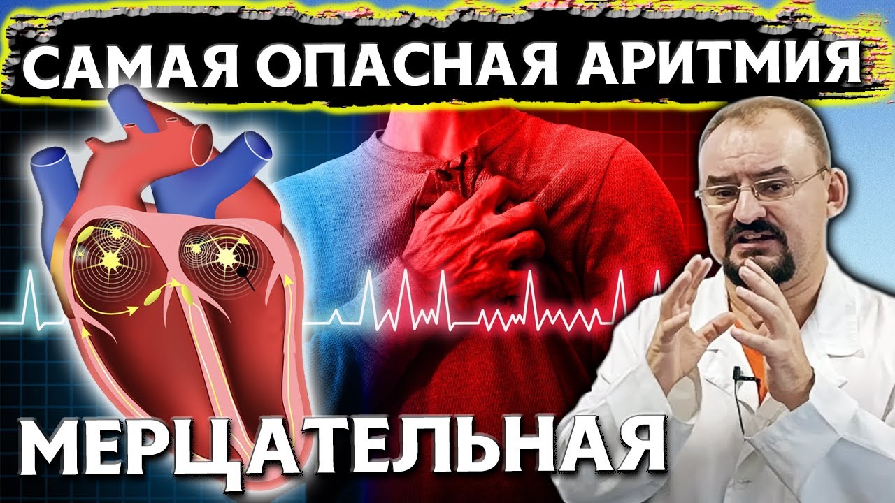 В этом ГЛАВНАЯ ПРИЧИНА аритмии. Основные проявления и лечение.