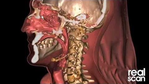 Real-Scan real time volumetric 3D in a browser