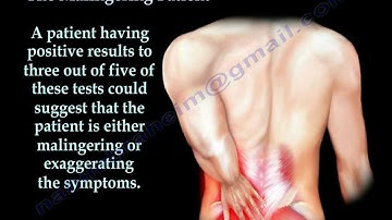 Low back pain , Accidents ,Malingering patient  - Everything You Need To Know - Dr. Nabil Ebraheim