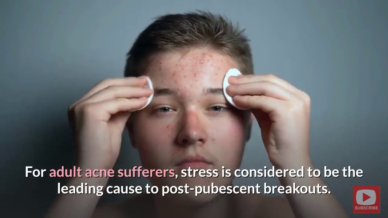 Acne Care For Adults - YouTube