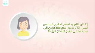 أهم 4 حالات تحتاج لزيارة الطبيب في الإصابة بالحزام الناري