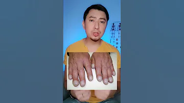 Проверьте у себя симптом 