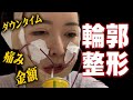 【整形】輪郭整形してきました