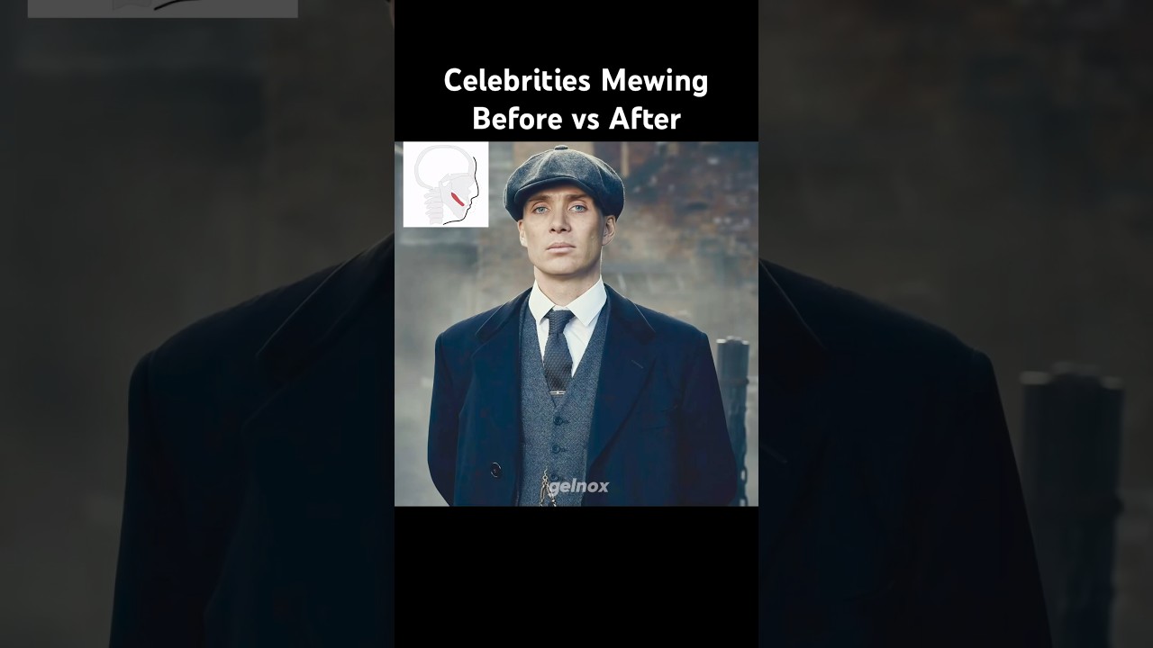 Celebrities Mewing