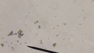 chilomonas paramecium under microscope (HPO)