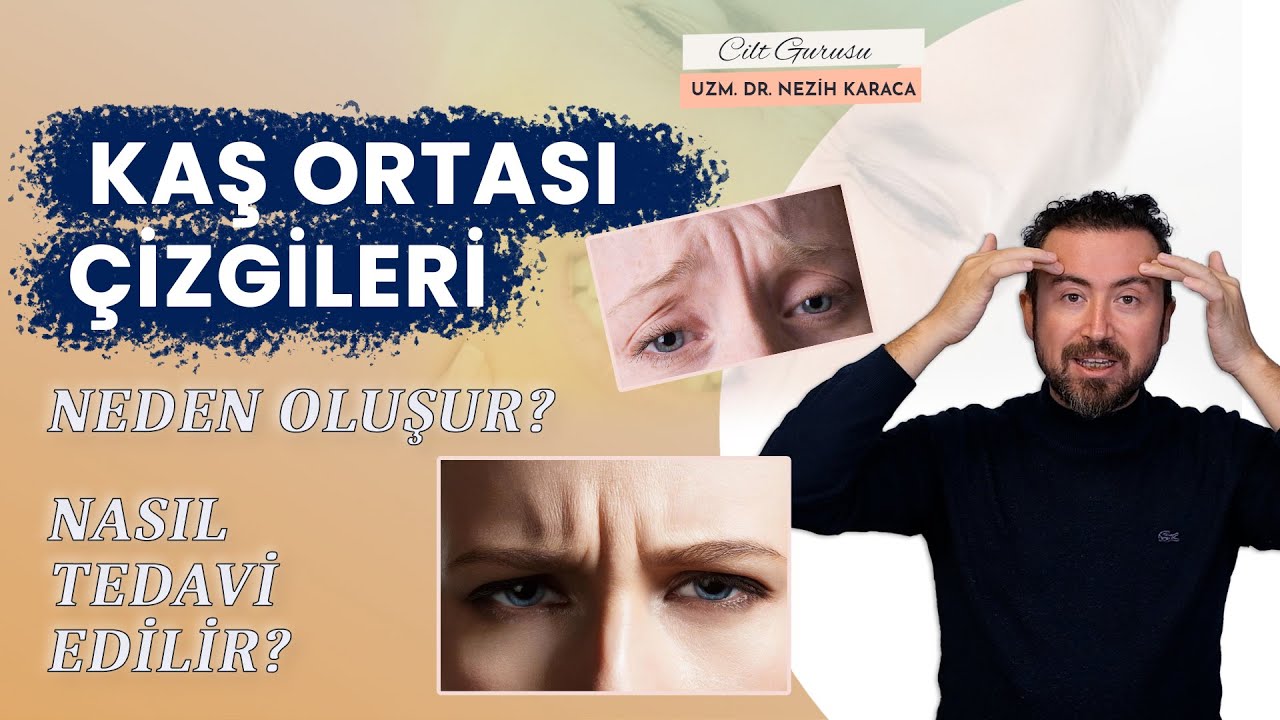 Kaş Ortası Çizgileri Neden Oluşur? Çözüm yöntemleri nelerdir?