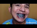 What happens when you stop brushing your teeth? by TopNewsage