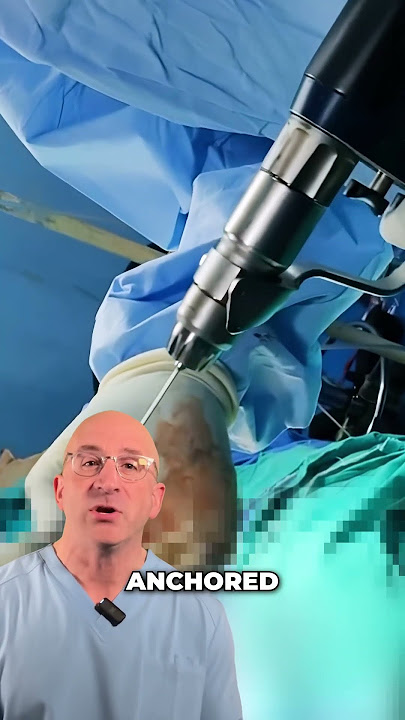 The Secret Tool That Fixes Impossible Bone Breaks!