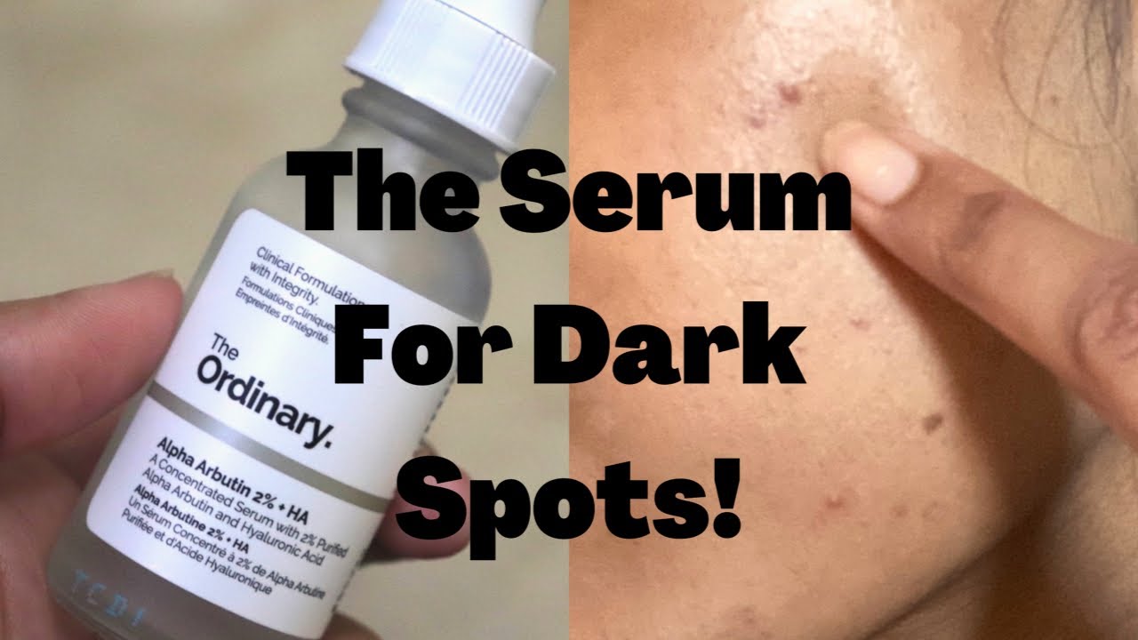 ALPHA ARBUTIN THE ORDINARY EVERYTHING YOU SHOULD KNOW YouTube