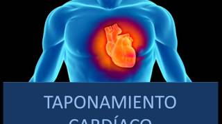 ¿Qué es el taponamiento cardíaco?