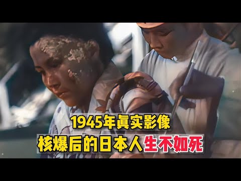 1945年真实影像，广岛核爆后日本人被烧成焦炭，上万人原地蒸发！
