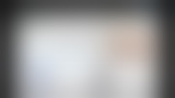 Anterior fracture dislocation of proximal humerus : When not to try closed reduction?