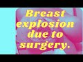 Fast news USA. A black woman had a breast explosion after plastic surgery.