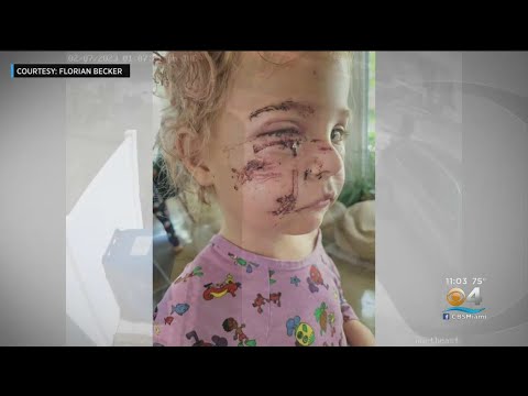 Family wants answers after young girl mauled by unknown dog