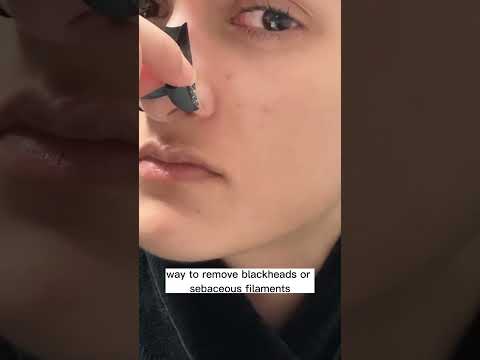 Stop Using Nose Strips For Blackheads