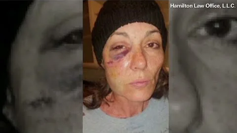 Woman alleges cop hurled her into cell, shattering...
