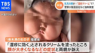 湿疹クリームで乳児の頭肥大疑惑 警察が製造会社など捜査 nスタ Youtube 湿疹クリームで乳児の頭肥大疑惑 警察が製造会社など捜査 nスタ Youtube