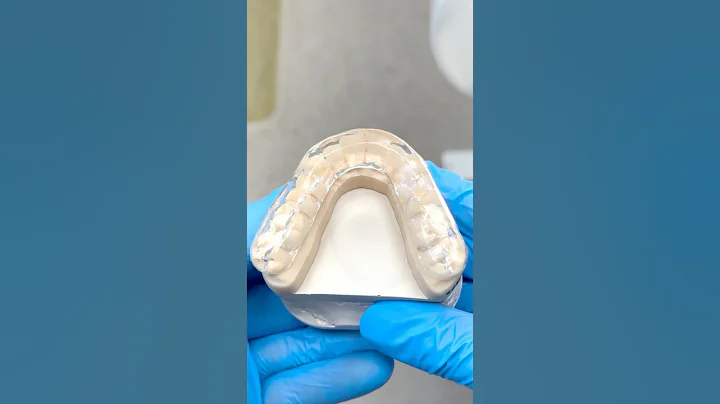 Hard/Soft Arcylic Night Guard @EnvisiontecMain #envisiontec #lsk121shorts #dentist