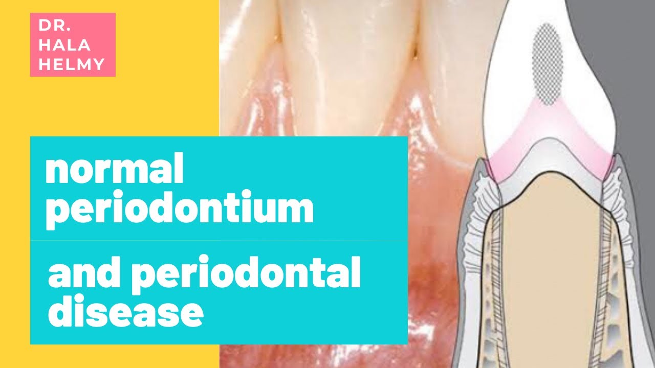 Intro of Periodontics | ( #1 Periodontal disease ) - YouTube