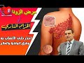 ما هو مرض الزونا ولماذا هو في ارتفاع و كيف فما هو الدكتور محمد فائد mp3
