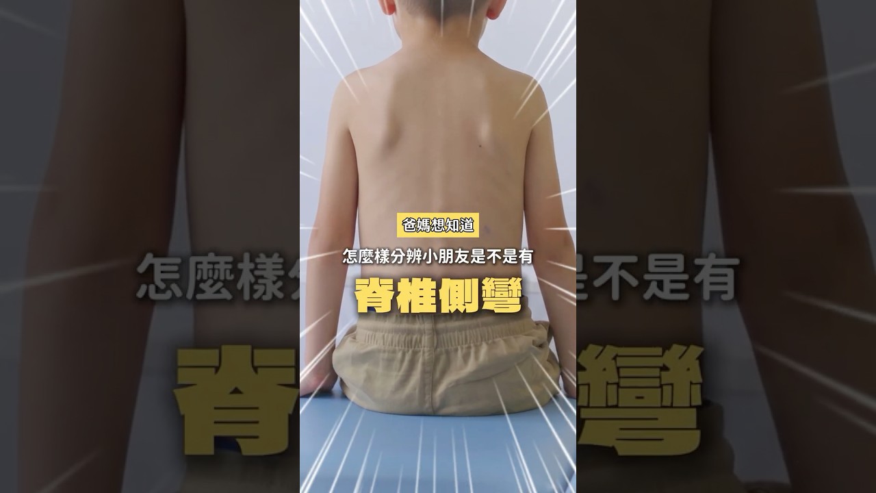 爸媽必看！小兒脊椎側彎怎麼看？ #小兒脊椎側彎 #兒童脊椎側彎 #脊椎側彎檢查 #亞當式前彎測試 #高低肩 #書包太重 #兒童健康 #光田綜合醫院 #向上院區 縮圖