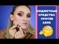 БЮДЖЕТНЫЙ УХОД для ПРОБЛЕМНОЙ КОЖИ❗️ КАК ИЗБАВИТЬСЯ ОТ ПРЫЩЕЙ