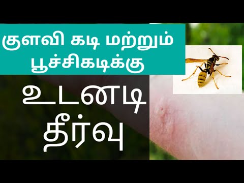 How to Treat Bee Sting