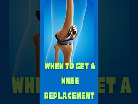Video thumbnail – ACL Reconstruction – explained by Dr. Devansh Goyal