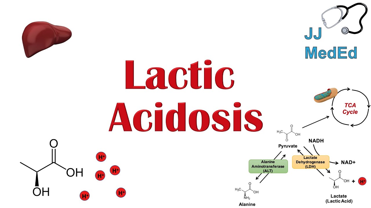 Lactic Acidosis: What is it, Causes (ex. metformin), and Subtypes A vs B