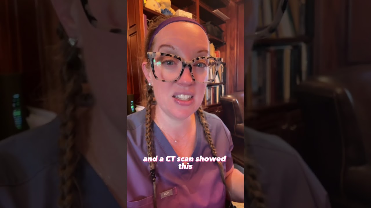 Case study 77 - left sided weakness 