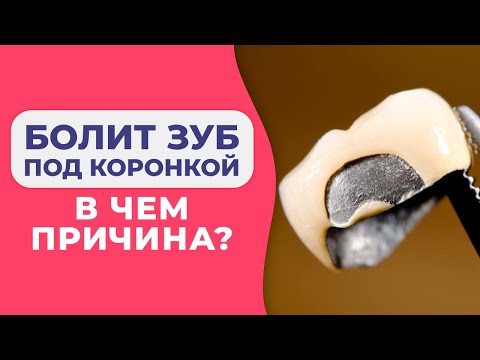 ВОСПАЛИЛАСЬ ДЕСНА ПОД КОРОНКОЙ / Болит десна под коронкой, как лечить?