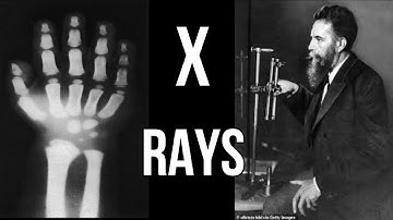 How Were X-Rays Accidentally Discovered || The Day a German Scientist Discovered X-Rays