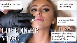 COME WITH ME TO GET LIP FILLER | FILLER VLOG AND Q&amp;A