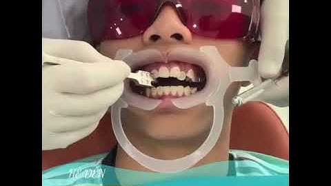 #3 #niengrang DỊCH CHUYỂN NHỎ, THAY ĐỔI LỚN