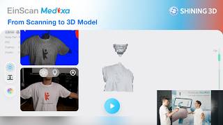 EinScan Medixa | Episode 2 – From Scanning to 3D Model🇬🇧🇺🇸