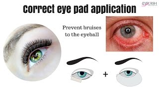 * IMPORTANT* CORRECT EYE PAD APPLICATION  prevent the bruised eyeball