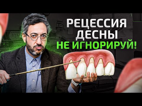 Уменьшилась десна и оголяются корни зубов. Рецессия десны (Не игнорируй это)