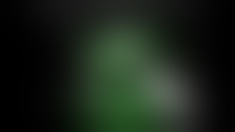 Near Infrared Fluorescence Imaging for Real-Time Assessment of Blood Flow in Totally Robotic TME