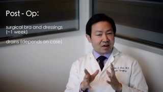 Breast Reduction Frequently Asked Questions