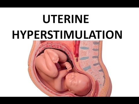 Video: Hypertonicity Of The Uterus