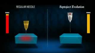 Septoject Evolution