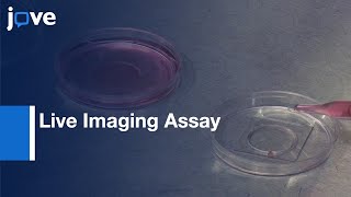 Assessing Roles Of Ca2+ & Sphingomyelinase In Repair of Pore-Forming Toxin Wounds l Protocol Preview